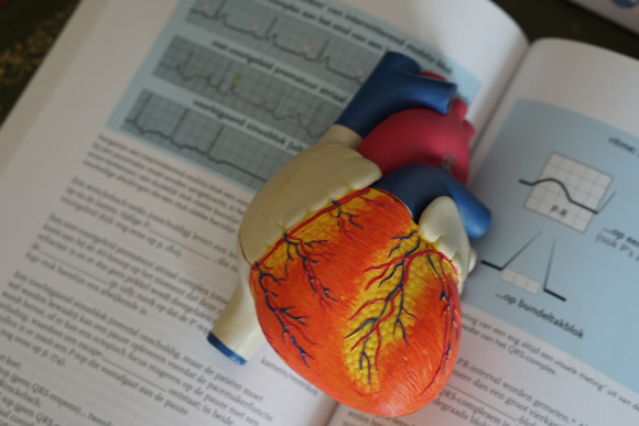 Heart model used by doctors to explain ways to improve circulation